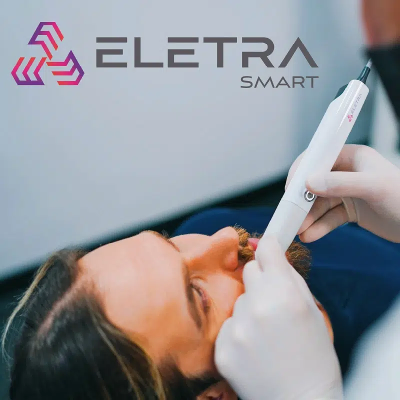 Présentation de l’ELETRA SMART
