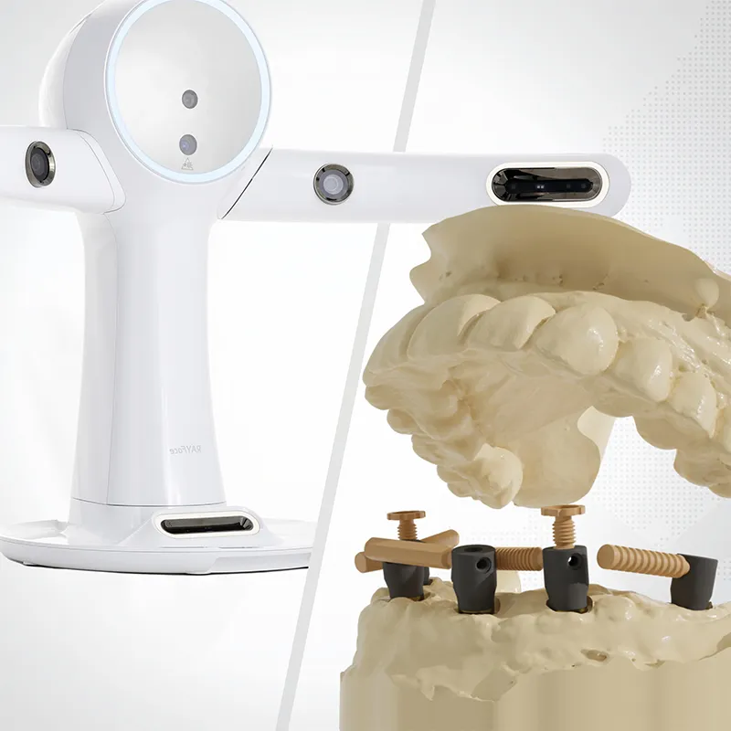 Avancée dans le traitement implantaire All-on-X : intégration du scanner RAYFace et de CAPS