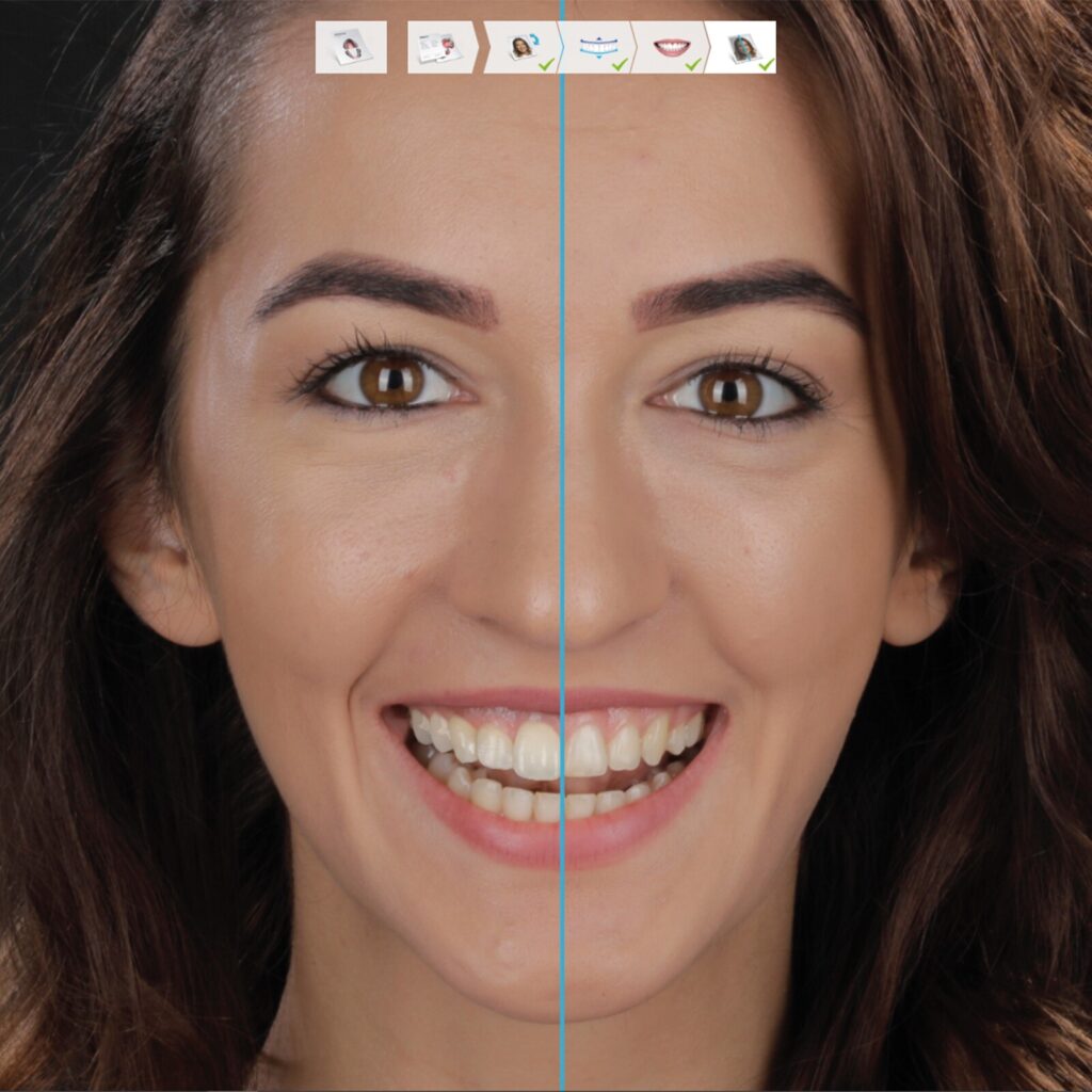 set up 1600px smile design (4)-min