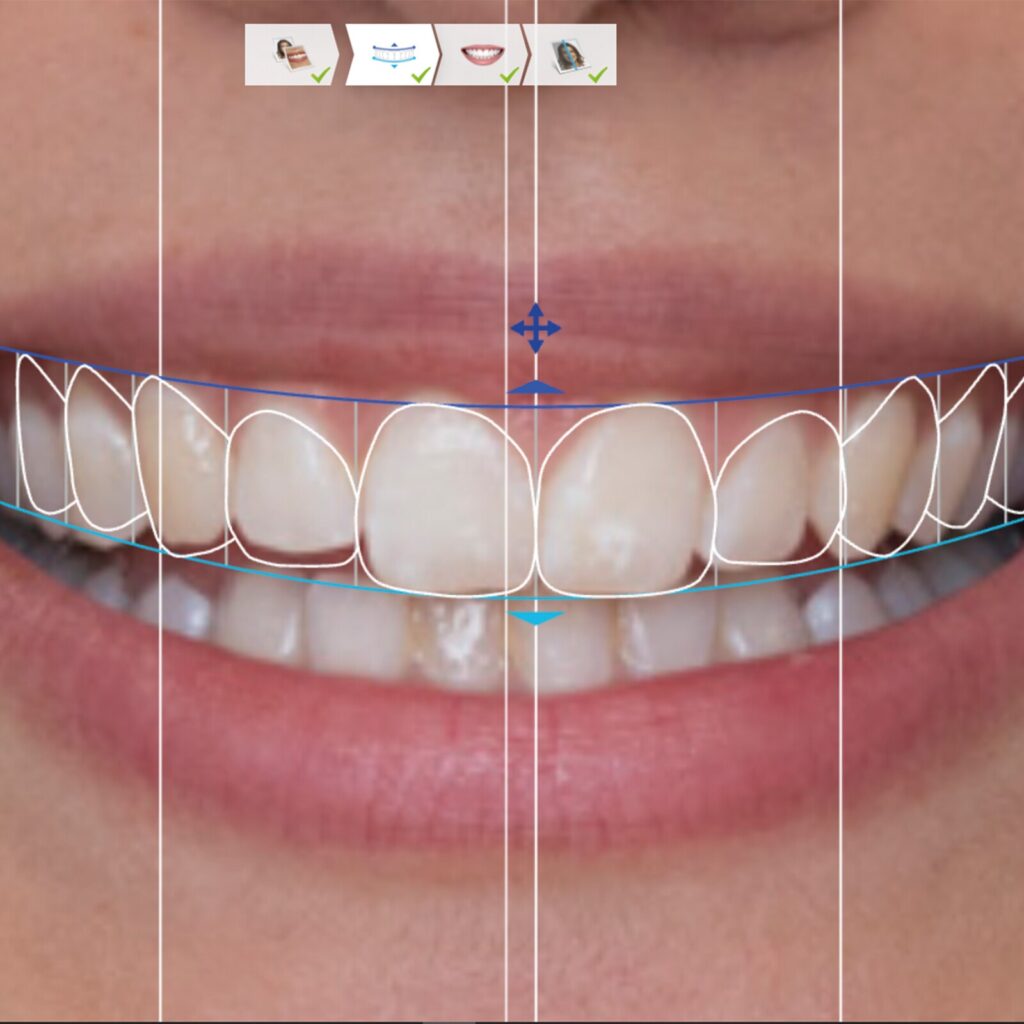 set up 1600px smile design (5)-min